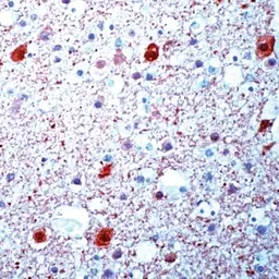 Anti-beta Synuclein antibody used in IHC (Paraffin sections) (IHC-P). GTX15532